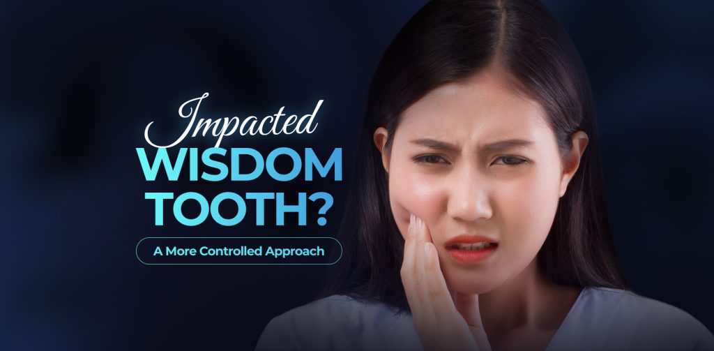 Impacted wisdom tooth removal with a more controlled approach at Cora Dental